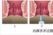 http://www.xcddgcyy.com/jishu/2018060559.html