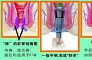 http://www.xcddgcyy.com/jishu/2018060562.html